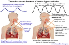 Kalp Çarpıntısı Nefes Darlığı